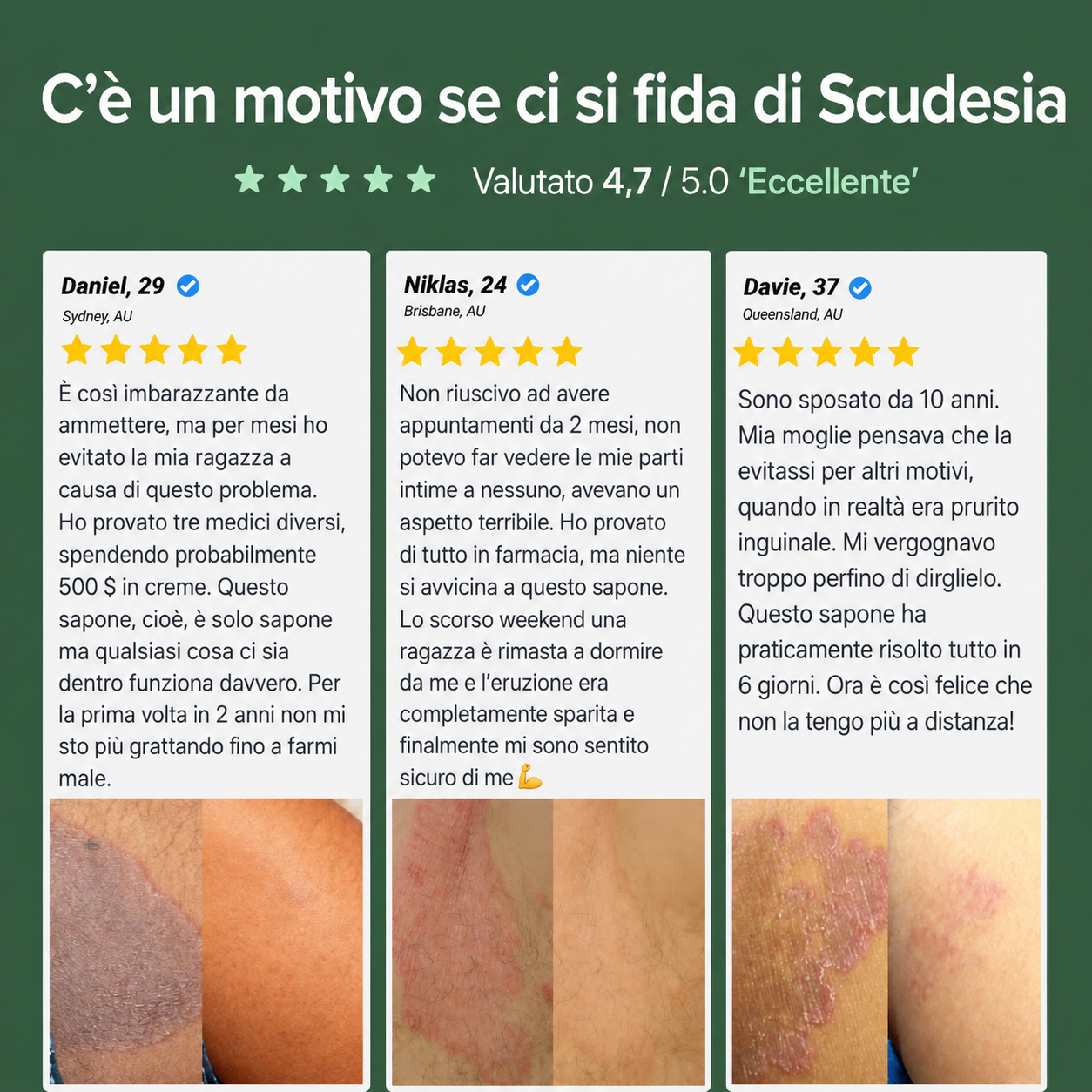 Sapone antimicotico Scudesia
