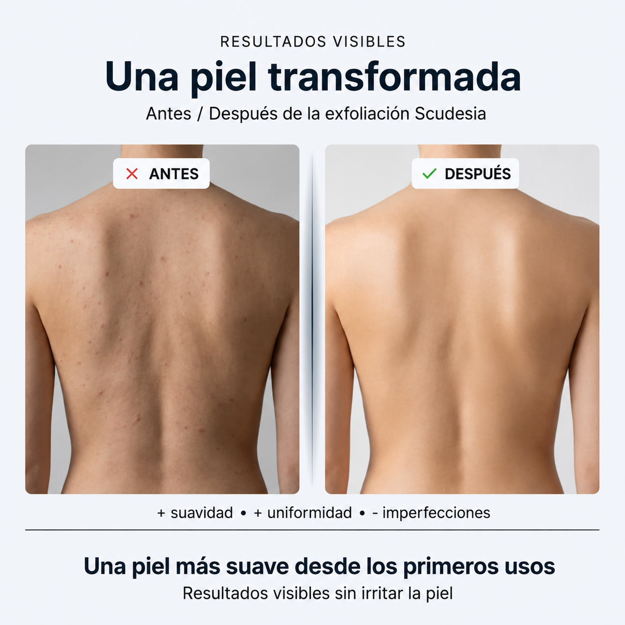 Toalla de ducha exfoliante Scudesia™