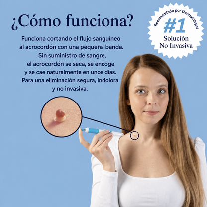 Scudesia Kit™ - No más acrocordones